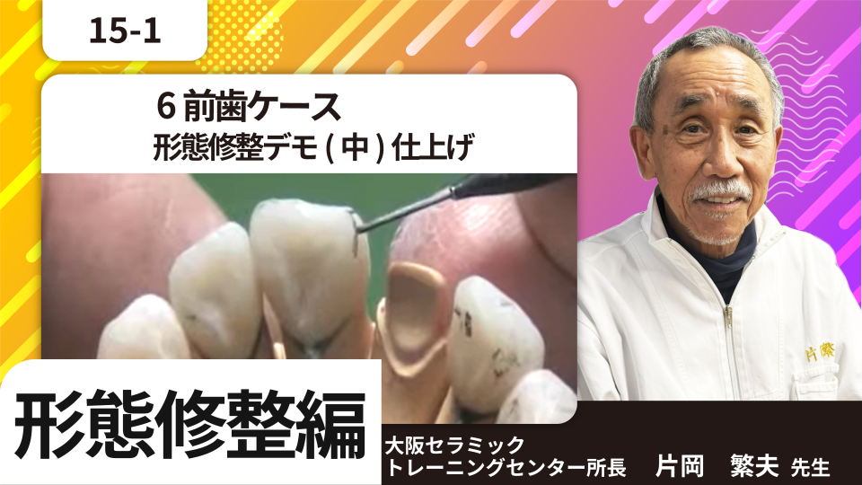 6前歯ケース 形態修整デモ(中)仕上げ | Global-DT-Sharing
