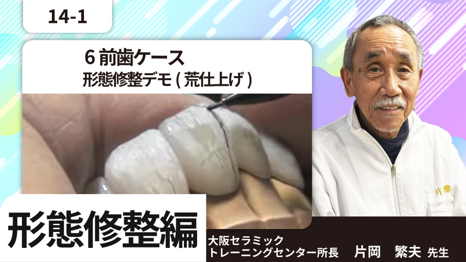 6前歯ケース 形態修整デモ(荒仕上げ) | Global-DT-Sharing